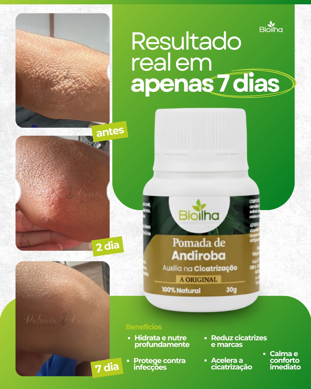 Pomada de Andiroba