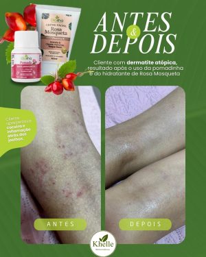 Pomada e Creme Rosa Mosqueta