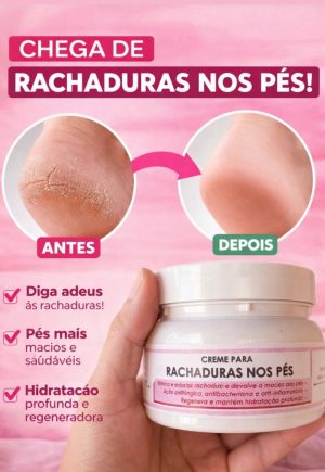 Creme para Rachadura nos Pés